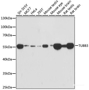 Western blot analysis of extracts of various cell lines using MMP8 Polyclonal Antibody at dilution of 1:1000.