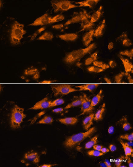 Western blot analysis of extracts of Mouse eye using NDP Polyclonal Antibody at dilution of 1:1000.