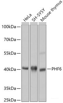Immunohistochemistry of paraffin-embedded Rat kidney using CCL22 Polyclonal Antibody at dilution of 1:100 (40x lens).