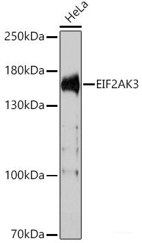 Western blot analysis of extracts of NCI-H460 cells using PLCB1 Polyclonal Antibody at dilution of 1:1000.