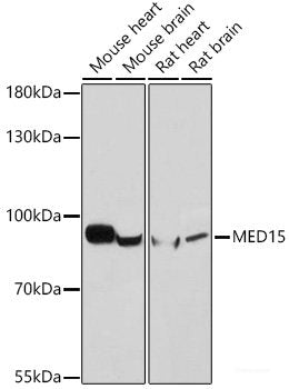 Western blot analysis of extracts of various cell lines using PSMB5 Polyclonal Antibody at dilution of 1:1000.