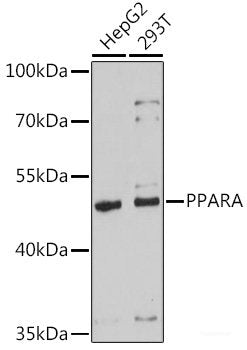 Western blot analysis of extracts of 22Rv1 cells using TMPRSS2 Polyclonal Antibody at dilution of 1:2000.