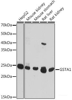 Immunohistochemistry of paraffin-embedded Human esophagus using MVP Polyclonal Antibody at dilution of 1:100 (40x lens).