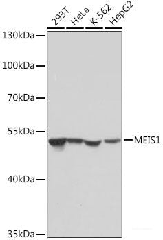 Immunohistochemistry of paraffin-embedded Human lung using ACVR2A Polyclonal Antibody at dilution of 1:100 (40x lens).