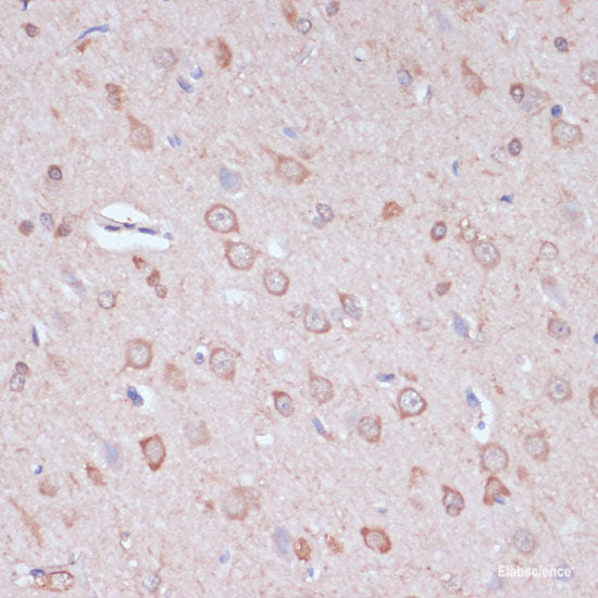 Immunofluorescence analysis of HeLa cells using CYP27A1 Polyclonal Antibody at dilution of 1:100 (40x lens). Blue: DAPI for nuclear staining.