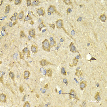Immunohistochemistry of paraffin-embedded Mouse liver using TCEB1 Polyclonal Antibody
