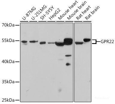 Immunohistochemistry of paraffin-embedded Rat spleen using APCS Polyclonal Antibody at dilution of 1:100 (40x lens).