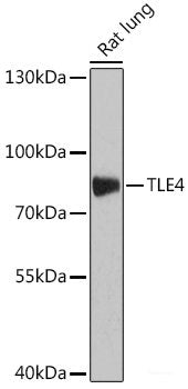 Western blot analysis of extracts of various cell lines using SMARCA5 Polyclonal Antibody at dilution of 1:1000.