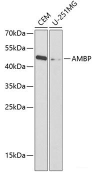 Western blot analysis of extracts of various cell lines using ASS1 Polyclonal Antibody at dilution of 1:3000.