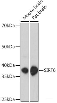 Immunohistochemistry of paraffin-embedded Human liver damage using CBLB Polyclonal Antibody at dilution of 1:200 (40x lens).