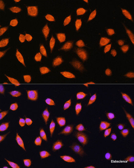 Western blot analysis of extracts of various cell lines using RPS19 Polyclonal Antibody at dilution of 1:1000.