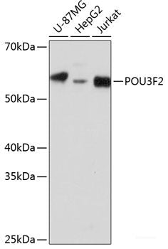 Immunohistochemistry of paraffin-embedded Rat spleen using NT5E / CD73 Polyclonal Antibody at dilution of 1:200 (40x lens).