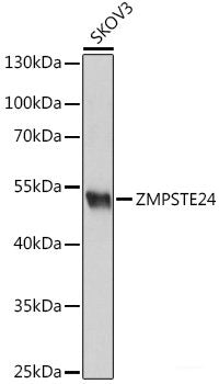 Immunofluorescence analysis of MCF-7 cells using CD79B Polyclonal Antibody