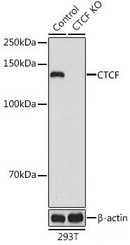 Immunohistochemistry of paraffin-embedded Rat lung using CDKN2C Polyclonal Antibody at dilution of 1:100 (40x lens).