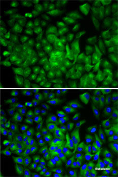 Immunohistochemistry of paraffin-embedded Rat kidney using RUNX1 Polyclonal Antibody at dilution of 1:100 (40x lens).