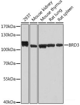 Western blot analysis of extracts of various cell lines using EPHX1 Polyclonal Antibody at dilution of 1:1000.