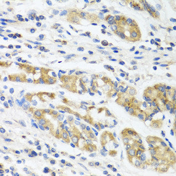Immunohistochemistry of paraffin-embedded Mouse liver using FGFR1 Polyclonal Antibody at dilution of 1:100 (40x lens).