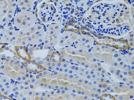 Immunofluorescence analysis of U2OS cells using KU70 Polyclonal Antibody at dilution of 1:100. Blue: DAPI for nuclear staining.
