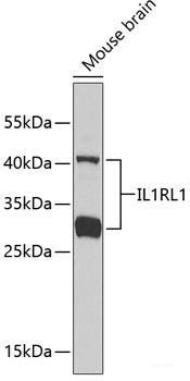 Immunofluorescence analysis of A549 cells using HCK Polyclonal Antibody