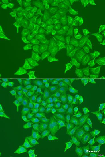 Immunohistochemistry of paraffin-embedded Rat kidney using HDAC2 Polyclonal Antibody at dilution of 1:100 (40x lens).