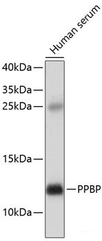 Immunohistochemistry of paraffin-embedded Mouse brain using IL13 Polyclonal Antibody