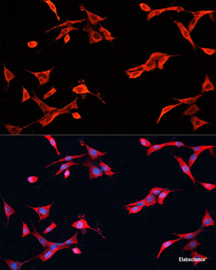 Western blot analysis of extracts of Ramos cells using MAPK7 Polyclonal Antibody at dilution of 1:1000.