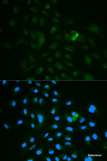 Western blot analysis of extracts of U-87MG cells using PSEN1 Polyclonal Antibody at dilution of 1:1000.