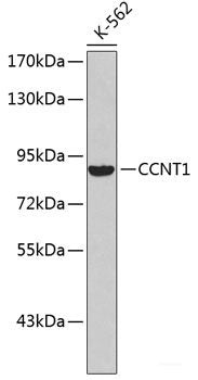 Western blot analysis of extracts of MCF-7 cells using DCTN2 Polyclonal Antibody at dilution of 1:1000.