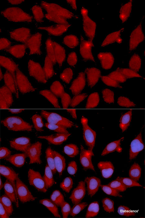 Immunohistochemistry of paraffin-embedded Rat heart using OGT Polyclonal Antibody at dilution of 1:100 (40x lens).