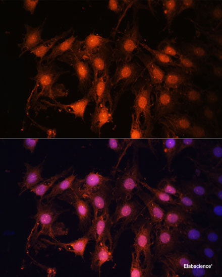 Immunohistochemistry of paraffin-embedded Mouse kidney using TSG101 Polyclonal Antibody at dilution of 1:100 (40x lens).