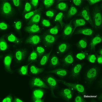 Immunohistochemistry of paraffin-embedded Rat testis using BRD3 Polyclonal Antibody at dilution of 1:100 (40x lens).