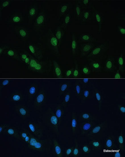 Western blot analysis of extracts of various cell lines using PRMT5 Polyclonal Antibody.