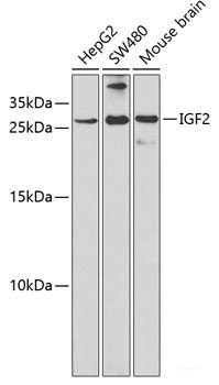 Western blot analysis of extracts of various cell lines using WHSC1L1 Polyclonal Antibody.