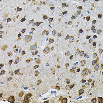 Immunohistochemistry of paraffin-embedded Mouse heart using HSPB2 Polyclonal Antibody at dilution of 1:200 (40x lens).