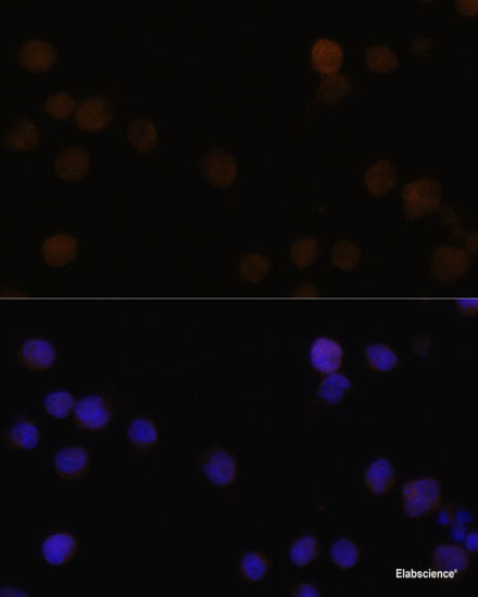 Western blot analysis of extracts of various cell lines using TriMethyl-Histone H3-K36 Polyclonal Antibody at dilution of 1:1000.