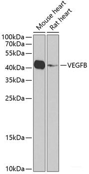 Western blot analysis of extracts of various cell lines using Symmetric DiMethyl-Histone H3-R2 Polyclonal Antibody.
