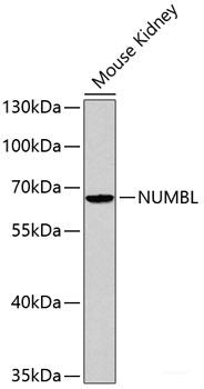 Western blot analysis of extracts of various cell lines using Asymmetric DiMethyl-Histone H3-R17 Polyclonal Antibody.