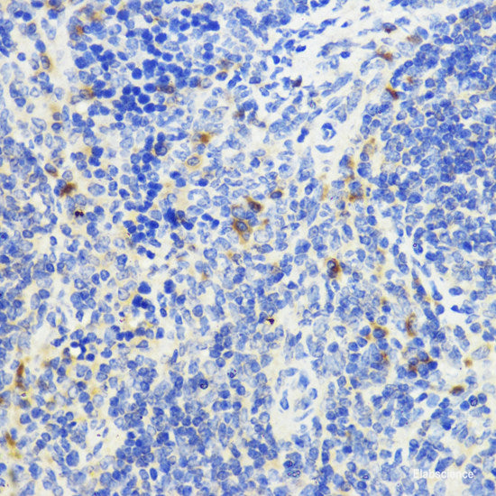 Immunohistochemistry of paraffin-embedded Rat brain using AXIN2 Polyclonal Antibody at dilution of 1:100 (40x lens).