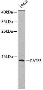 Immunohistochemistry of paraffin-embedded Rat ovary using CYP3A4 Polyclonal Antibody at dilution of 1:100 (40x lens).