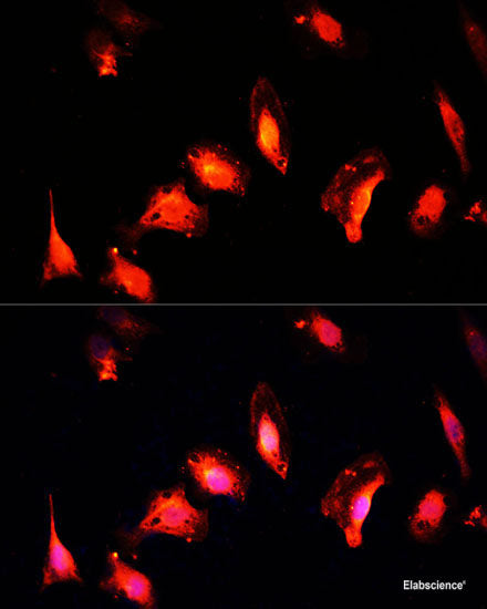 Immunohistochemistry of paraffin-embedded Human stomach using NF-kB p65 Polyclonal Antibody at dilution of 1:200 (40x lens).