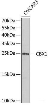 Immunohistochemistry of paraffin-embedded Rat heart using IRF2 Polyclonal Antibody at dilution of 1:200 (40x lens).