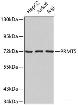 Immunohistochemistry of paraffin-embedded Mouse lung using SKP1 Polyclonal Antibody at dilution of 1:100 (40x lens).