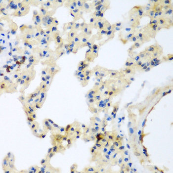 Immunofluorescence analysis of HeLa cells using WNK1 Polyclonal Antibody