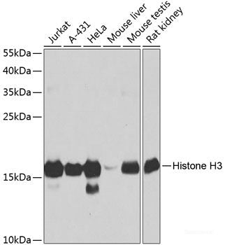 Immunofluorescence analysis of HeLa cells using LAMP1 Polyclonal Antibody at dilution of 1:100. Blue: DAPI for nuclear staining.