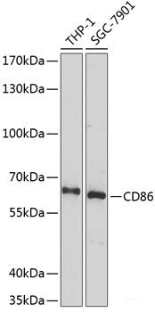 Western blot analysis of extracts of Mouse brain using PRNP Polyclonal Antibody at dilution of 1:1000.