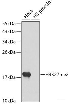 Western blot analysis of extracts of various cell lines using CCL28 Polyclonal Antibody at dilution of 1:1000.