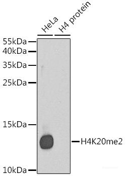 Immunohistochemistry of paraffin-embedded Human liver damage using MAT1A Polyclonal Antibody at dilution of 1:100 (40x lens).