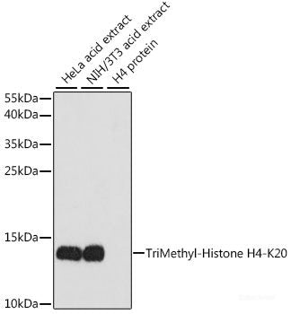 Western blot analysis of extracts of various cell lines using APLP1 Polyclonal Antibody at dilution of 1:1000.