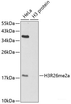 Immunohistochemistry of paraffin-embedded Mouse heart using COX6B1 Polyclonal Antibody at dilution of 1:100 (40x lens).