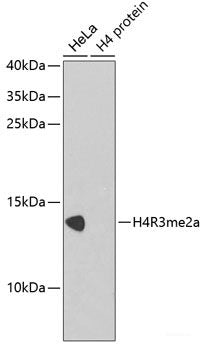 Immunohistochemistry of paraffin-embedded Human liver damage using ABCB8 Polyclonal Antibody at dilution of 1:100 (40x lens).